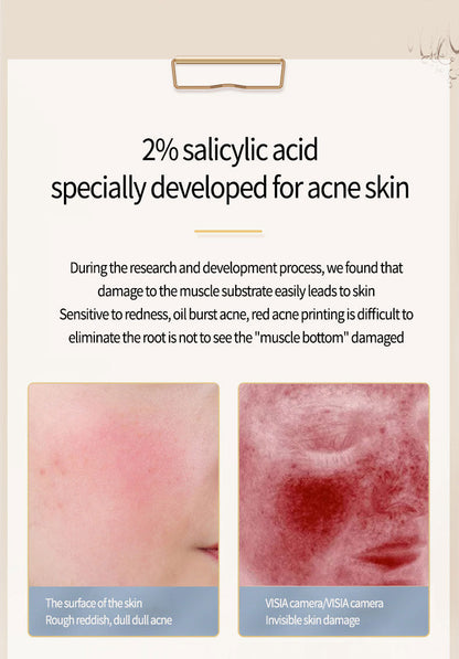 Acne Removing Salicylate Products Sensory Smiles