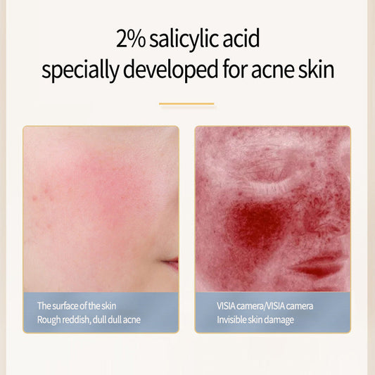 Acne Removing Salicylate Products Sensory Smiles